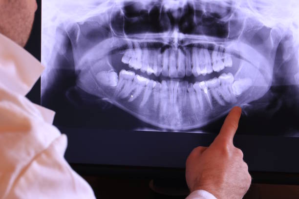 Best Broken Tooth Emergency  in Hillsboro, ND