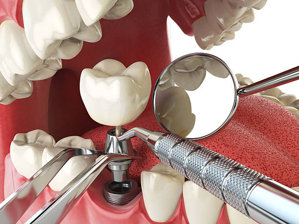 Best Urgent Tooth Repair  in Hillsboro, ND